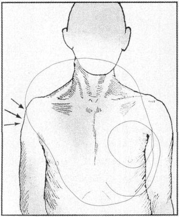 五、腋神經(jīng)